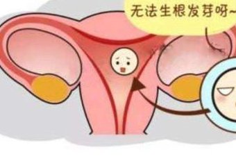 薄型子宫内膜女性做三代试管的移植方案？