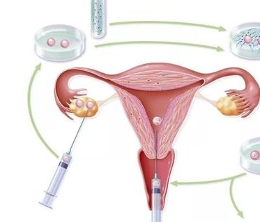 试管多次移植生化后，这样准备让再次移植成功率翻倍！